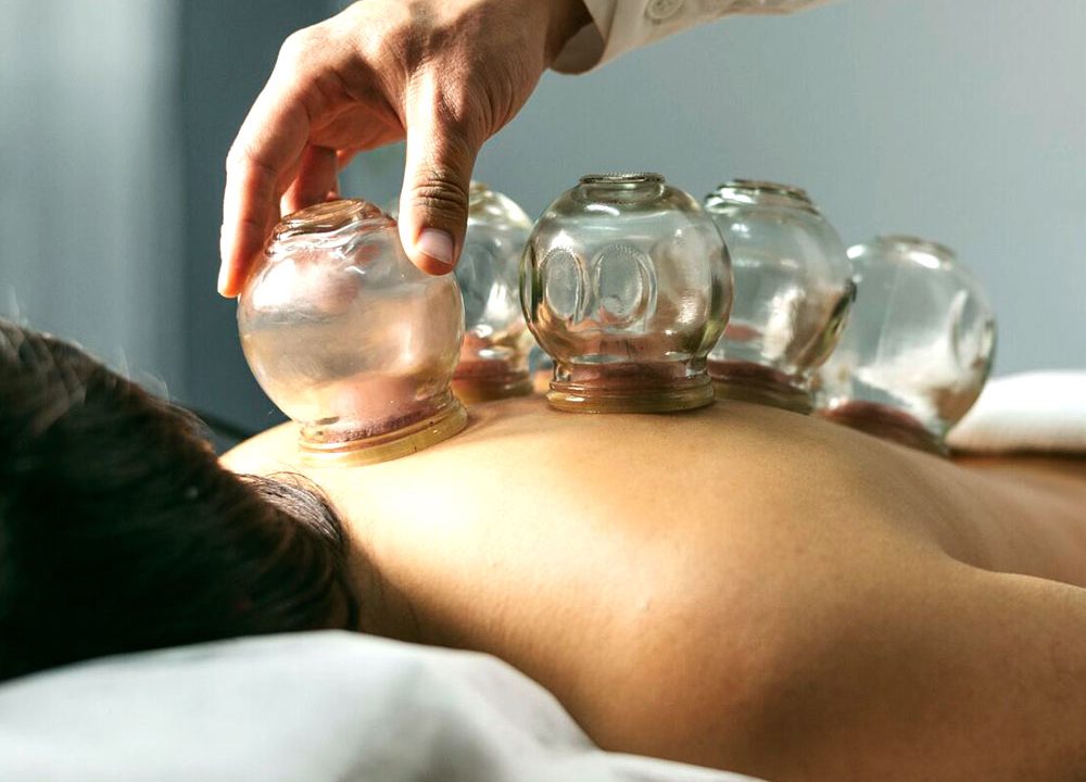 https://massagedublin.pro/wp-content/uploads/2021/06/cupping-massage-1000x720.jpg