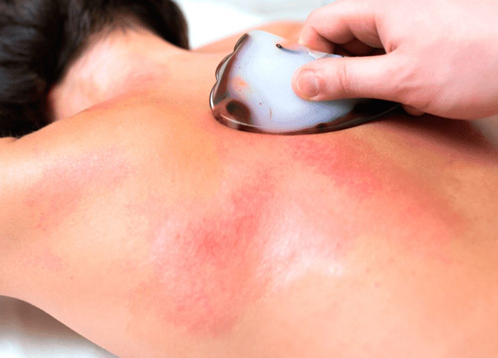 https://massagedublin.pro/wp-content/uploads/2021/06/guasha-massage-1000x720.jpg
